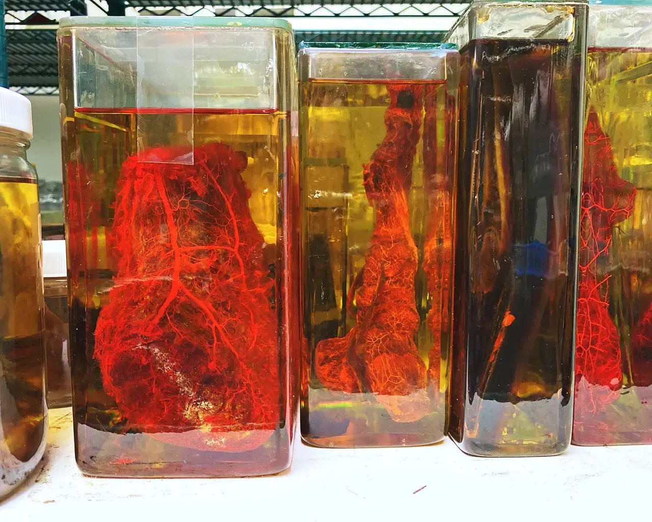 Collection of vascularized wet specimens in climate-controlled storage at the Mütter Museum, Philadelphia PA. Photo courtesy of The College of Physicians of Philadelphia.