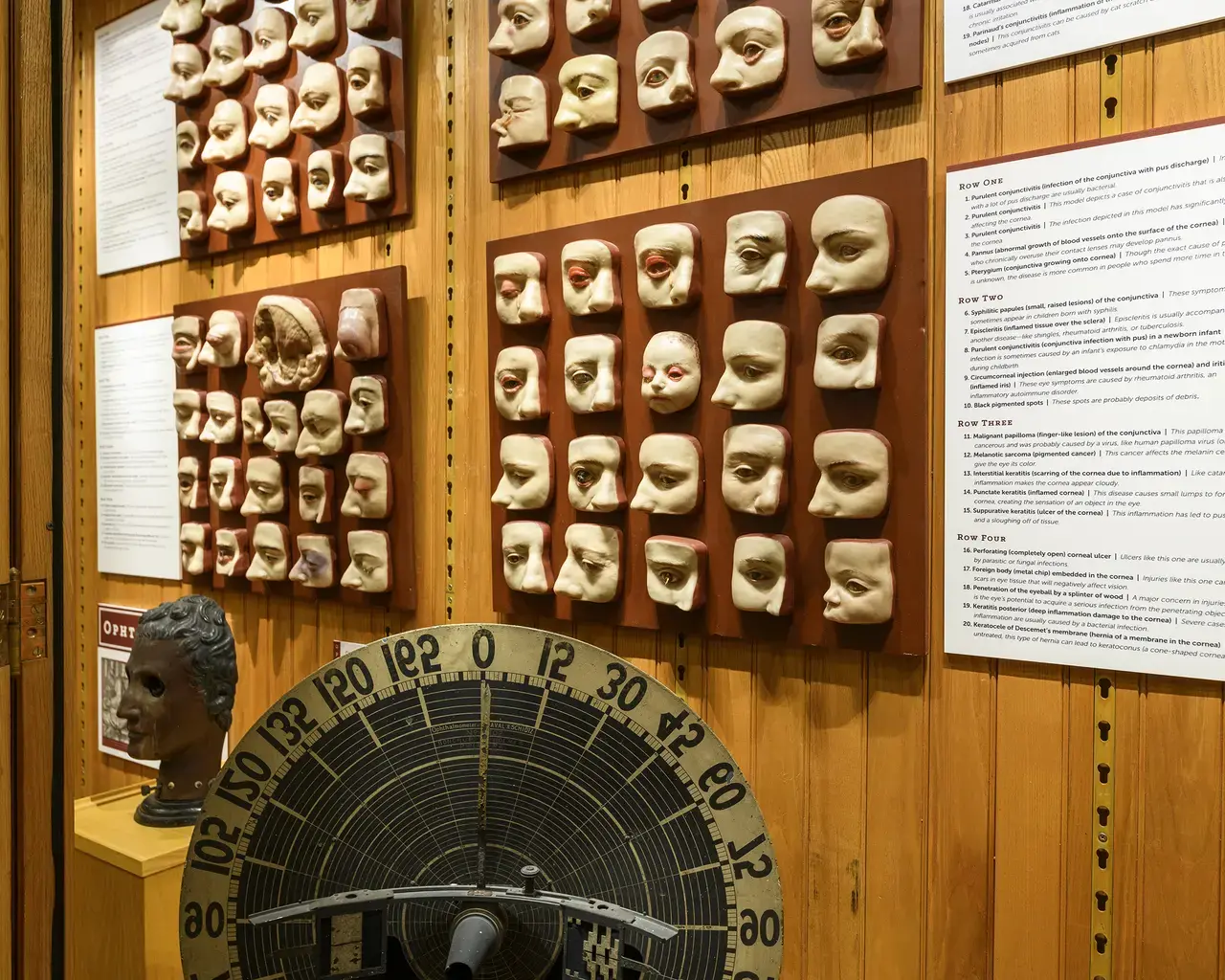 A display of wax models showing various eye conditions used to train physicians at the Mütter Museum. Photo by Constance Mensh.