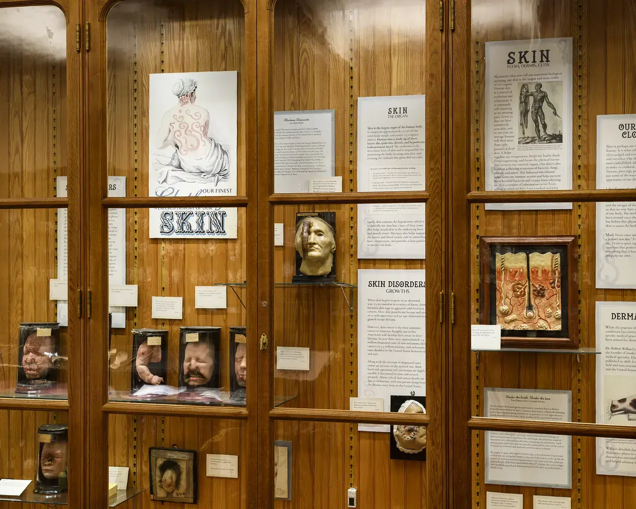 A display of wax models illustrating skin disorders at the Mütter Museum.